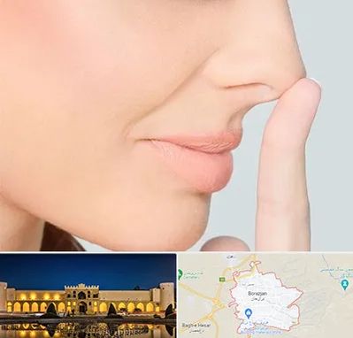عمل تیپ پلاستی بینی در برازجان