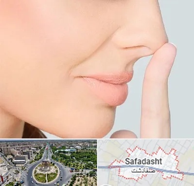 عمل تیپ پلاستی بینی در صفادشت