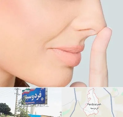 عمل تیپ پلاستی بینی در فردوسیه شهریار