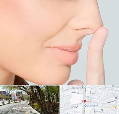 عمل تیپ پلاستی بینی در خیابان توحید اصفهان