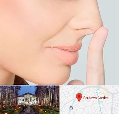 عمل تیپ پلاستی بینی در باغ فردوس