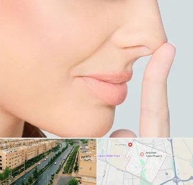 عمل تیپ پلاستی بینی در فاز سه اندیشه
