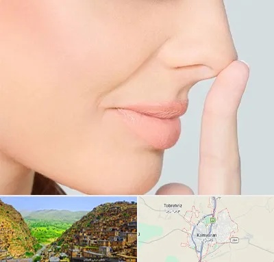 عمل تیپ پلاستی بینی در کامیاران