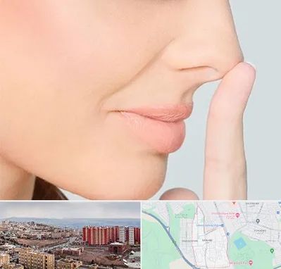 عمل تیپ پلاستی بینی در سهند تبریز