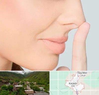 عمل تیپ پلاستی بینی در کلاله