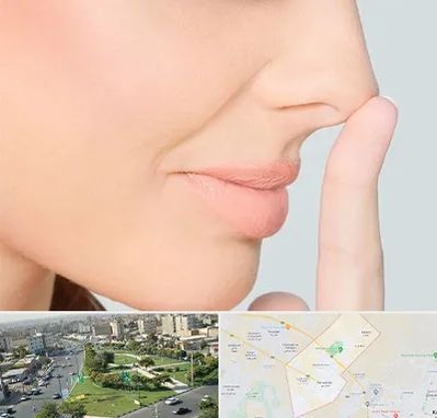 عمل تیپ پلاستی بینی در کمال شهر کرج