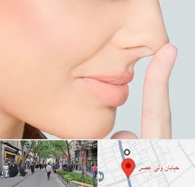 عمل تیپ پلاستی بینی در ولیعصر شهریار