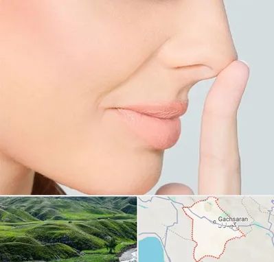 عمل تیپ پلاستی بینی در گچساران