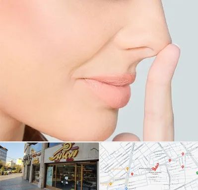 عمل تیپ پلاستی بینی در عطاران قم