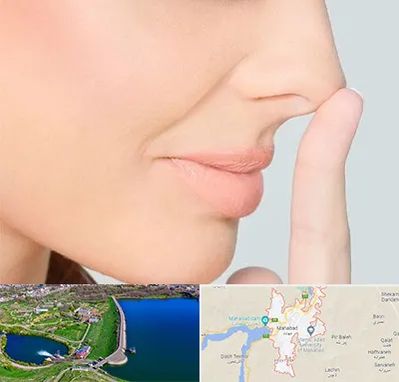 عمل تیپ پلاستی بینی در مهاباد