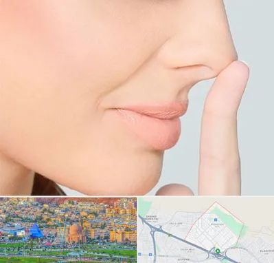 عمل تیپ پلاستی بینی در رشدیه تبریز