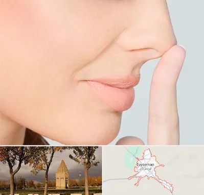 عمل تیپ پلاستی بینی در تویسرکان
