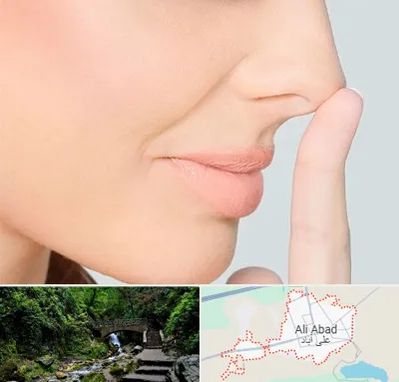عمل تیپ پلاستی بینی در علی آباد کتول