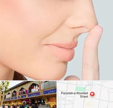 عمل تیپ پلاستی بینی در 15 خرداد