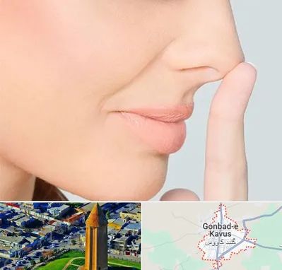 عمل تیپ پلاستی بینی در گنبد کاووس
