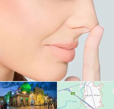 عمل تیپ پلاستی بینی در آستانه اشرفیه