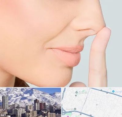 عمل تیپ پلاستی بینی در ازگل