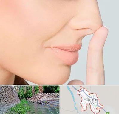 عمل تیپ پلاستی بینی در سراوان