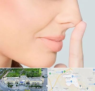 عمل تیپ پلاستی بینی در نسیم شهر