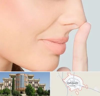 عمل تیپ پلاستی بینی در دهدشت