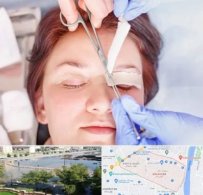 جراحی پلک افتاده در گلستان اهواز