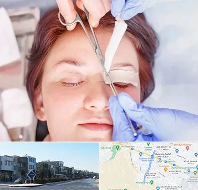 جراحی پلک افتاده در شریعتی مشهد