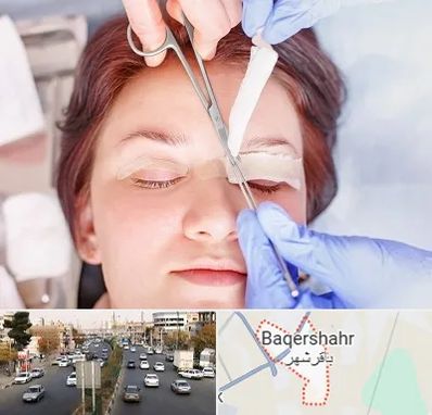 جراحی پلک افتاده در باقرشهر