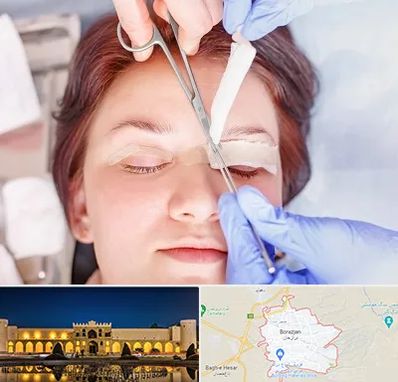 جراحی پلک افتاده در برازجان