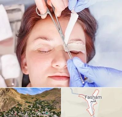 جراحی پلک افتاده در فشم