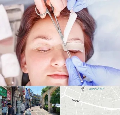 جراحی پلک افتاده در خیابان قزوین
