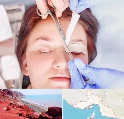 جراحی پلک افتاده در هرمزگان
