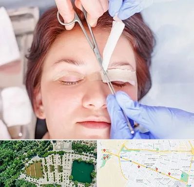 جراحی پلک افتاده در وکیل آباد مشهد