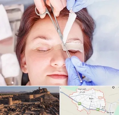 جراحی پلک افتاده در بم