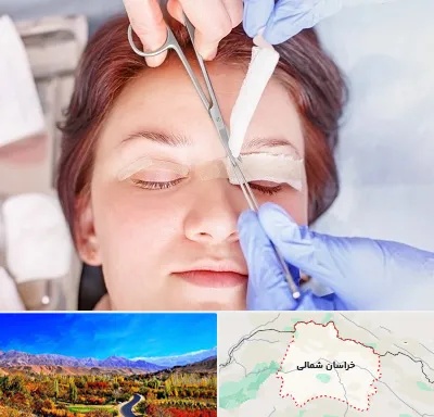 جراحی پلک افتاده در خراسان شمالی