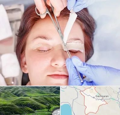 جراحی پلک افتاده در گچساران