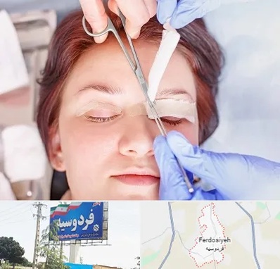 جراحی پلک افتاده در فردوسیه شهریار