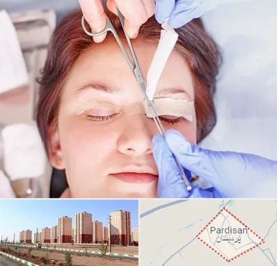 جراحی پلک افتاده در پردیسان قم
