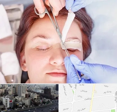 جراحی پلک افتاده در زرتشت