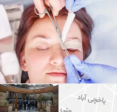 جراحی پلک افتاده در یاخچی آباد