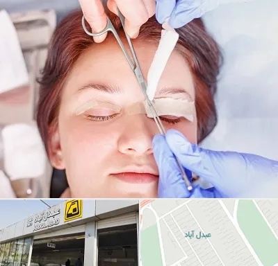 جراحی پلک افتاده در عبدل آباد