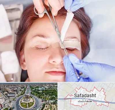 جراحی پلک افتاده در صفادشت