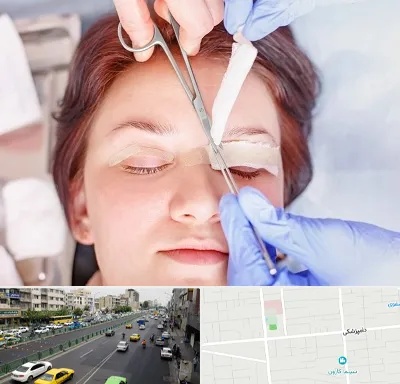 جراحی پلک افتاده در خیابان دامپزشکی