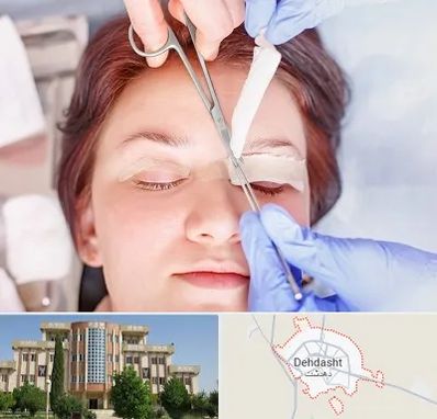 جراحی پلک افتاده در دهدشت