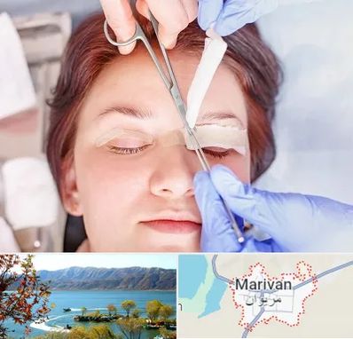 جراحی پلک افتاده در مریوان