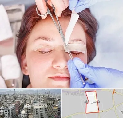 جراحی پلک افتاده در شمس آباد تهران