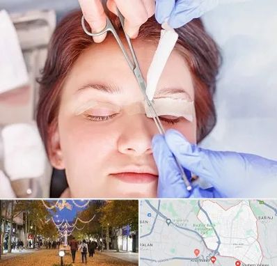 جراحی پلک افتاده در ولیعصر ارومیه