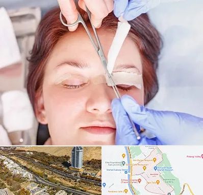 جراحی پلک افتاده در خیابان نیایش شیراز