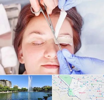 جراحی پلک افتاده در کوهسنگی مشهد