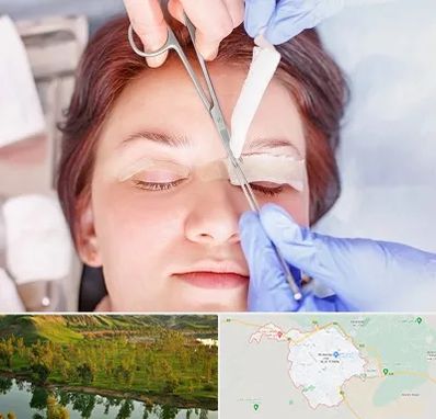 جراحی پلک افتاده در بهبهان