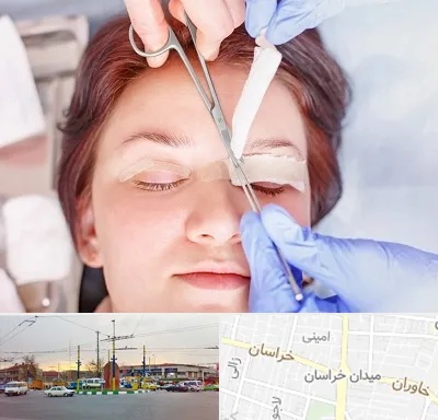 جراحی پلک افتاده در میدان خراسان